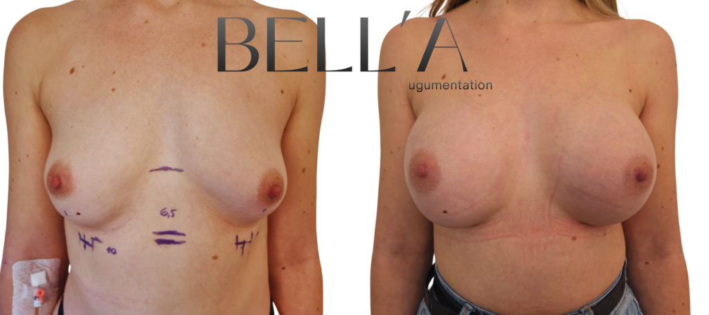 Metoda Bella Januszewski