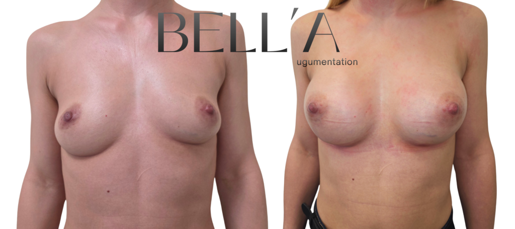 Metoda Bella Januszewski